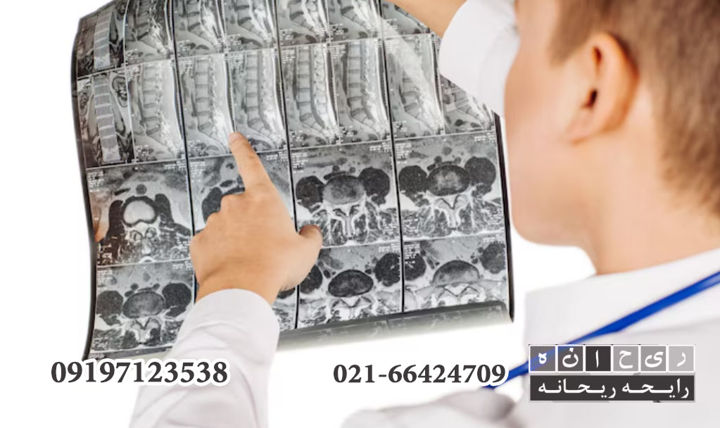 تبدیل CD به کلیشه